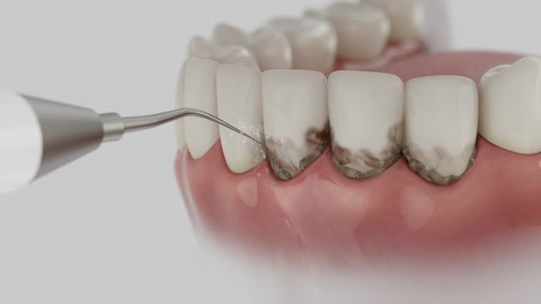 Trusted Invisalign Clear Aligners service in Fayetteville, NC - Dentist Open Now